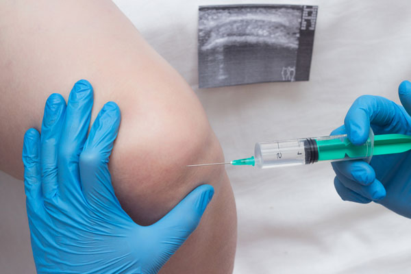 Steroid Injection In Knee