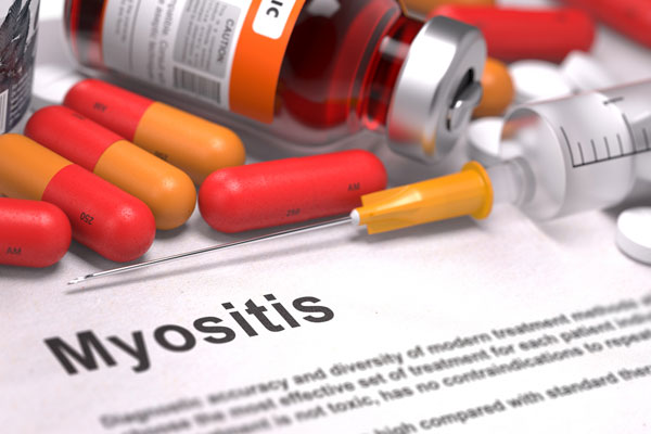 What is Myositis