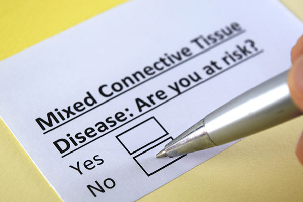 What is Mixed Connective Tissue Disease (MCTD)?