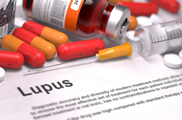 Vasculitis With Lupus