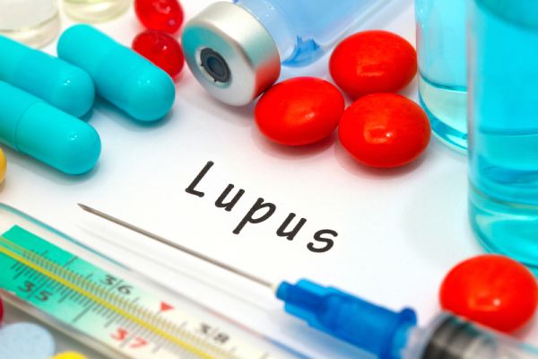 Lupus or RA