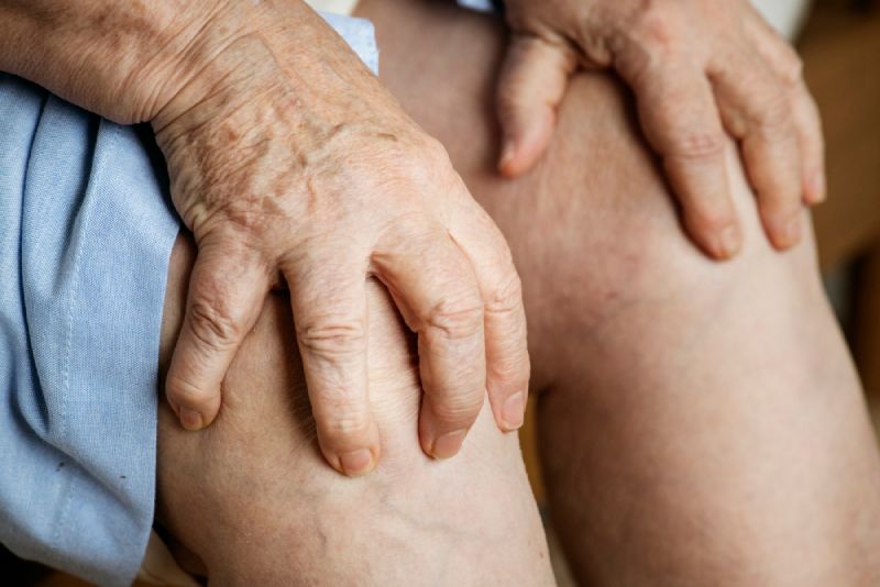 Can You Become ‘Crippled’ From Psoriatic Arthritis?
