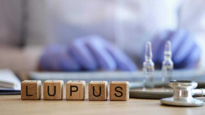 Can you Live Well with Lupus?