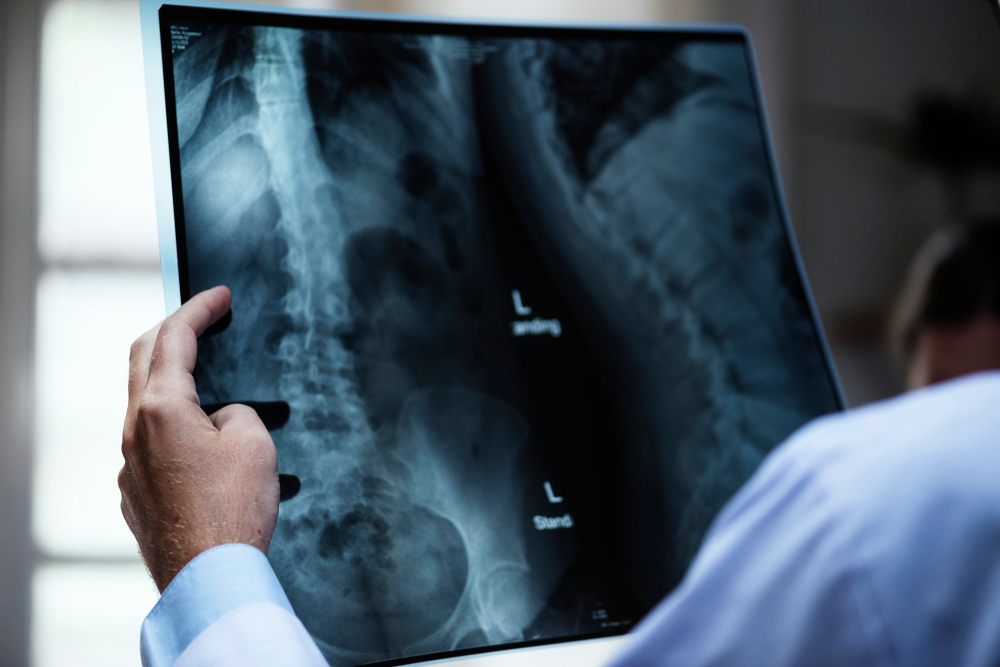 What are the main causes of osteoporosis?
