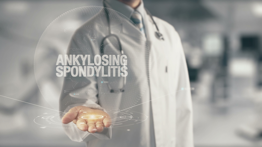 What are the warning signs of ankylosing spondylitis?