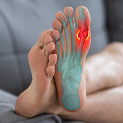 Gout