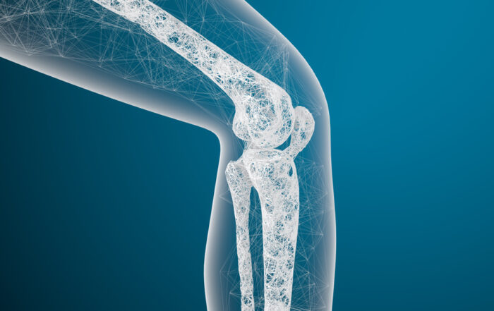 How To Reduce Your Risk Of Osteoporosis