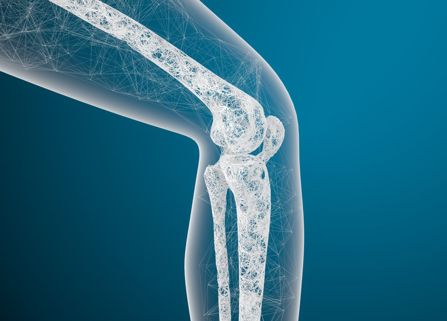 How To Reduce Your Risk Of Osteoporosis